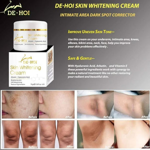 DE HOI Skin Whitening Cream – Brightening &amp; Moisturizing Face and Body Cream for Dark Skin - 75 gram