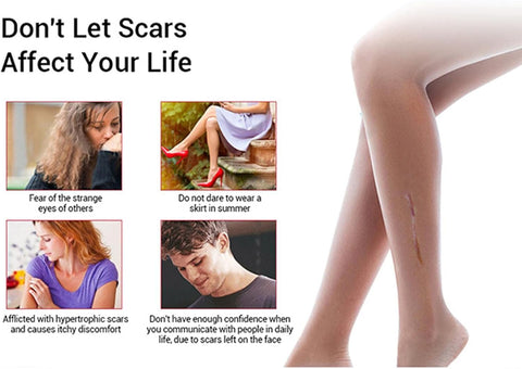 Acne Scar Removal Rejuvenation Serum | Scar, C section &amp; Stretch Mark Removal Oil for women