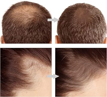 2in1 Hairline &amp; Eyebrow Shaping Stamp