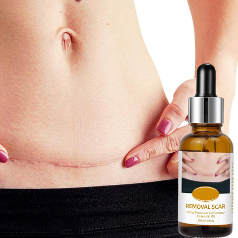 Acne Scar Removal Rejuvenation Serum | Scar, C section &amp; Stretch Mark Removal Oil for women