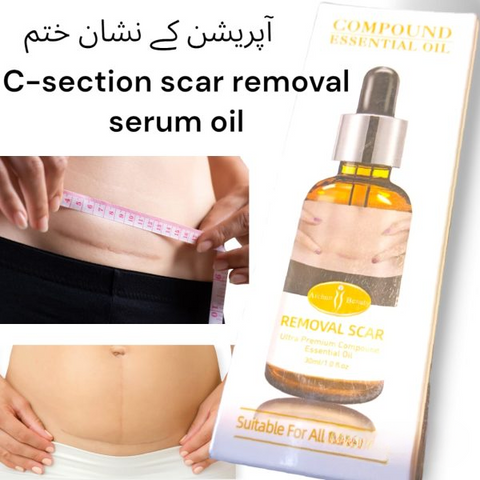 Acne Scar Removal Rejuvenation Serum | Scar, C section &amp; Stretch Mark Removal Oil for women
