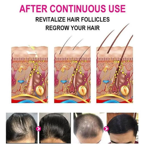 Anti-Grey Hair Serum, 30Ml