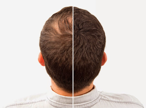 Caboki Hair Building Fibers  25g | Black | Dark Brown Hair building fibers  adds volume to thin hair