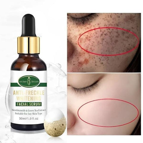 100% original Aichun Anti Freckle Whitening Facial Serum 30ml