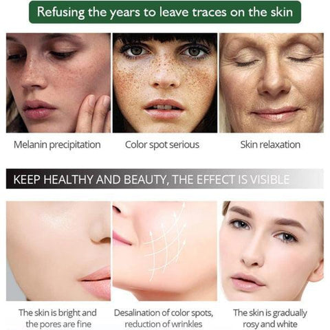 100% original Aichun Anti Freckle Whitening Facial Serum 30ml