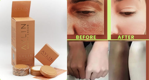 Aylin Beauty Cream Best Cream Ever | Best Quality Cream |  Aylin Beauty Cream For Face Acne Pimples, &amp; Blackheads | Whitening Cream ( Original )