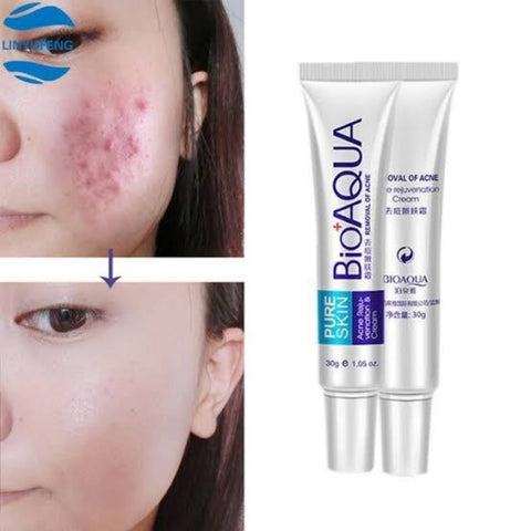 BIOAQUA Anti Acne Cream Acne Scar Removal Cream | Best Quality Scar Removal Cream 30g( Original )