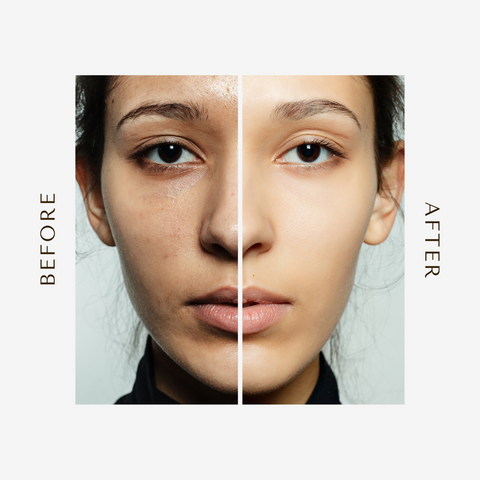 Glow natural Glutathione Alpha Arbutin Skin Brightening Cream (50g)