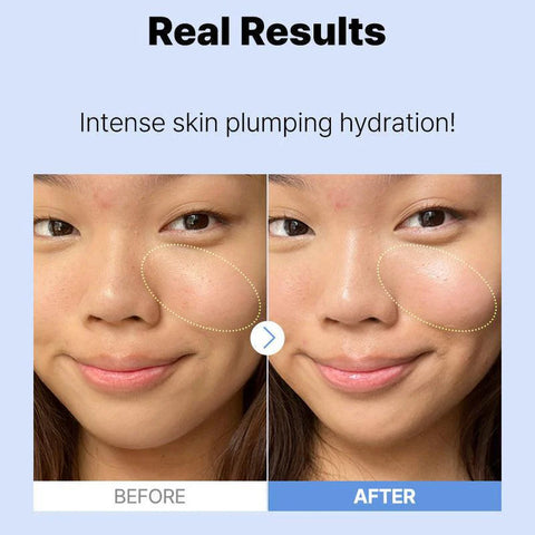 COSRX Pure Sodium Hyaluronic Acid 3% Serum, Hydration &amp; Moisture Boosting Facial Serum for Fine Lines &amp; Wrinkles, Plump &amp; Repair Dry Skin 20ml